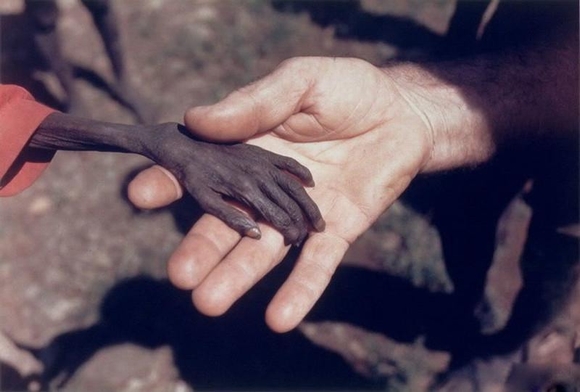 Bức ảnh về nạn đói ở Châu Phi năm 1980. Bức ảnh miêu tả đôi bàn tay teo tóp vì đóicủa một đứa bé đang hấp hối trong lòng bàn tay nhà truyền giáo. Sự giúp đỡ tuy muộn màng nhưng đã nhen nhóm trong ta sự hy vọng về một thế giới tốt đẹp hơn trong tương lai.